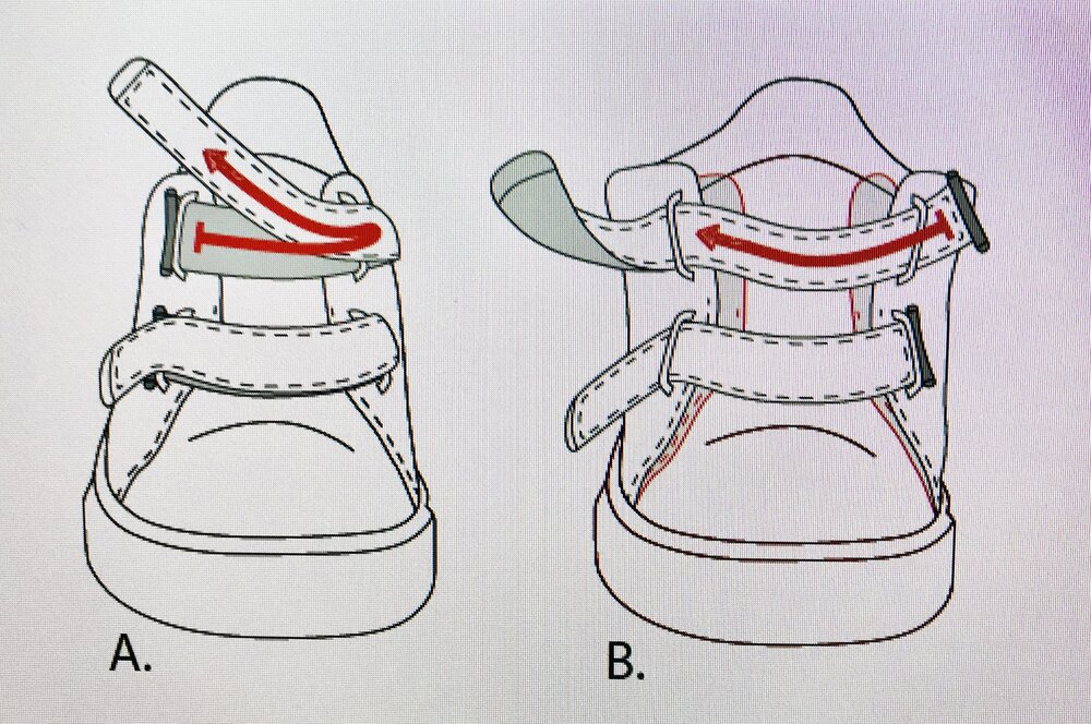 My Generation Ortheseschoen Laag Model (b) PECORE